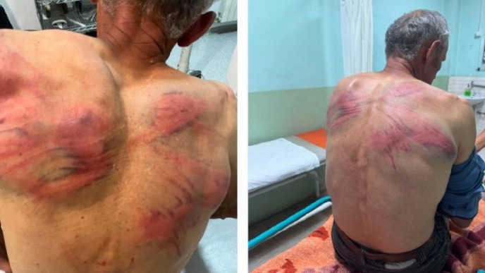Osuda prebijanja Raškovića